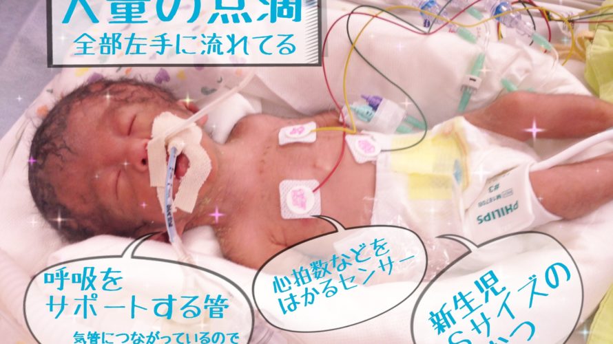 産まれてからすぐに胃ろう造設術とEDチューブ挿入術!誕生した日の15時間を話します 【後編】