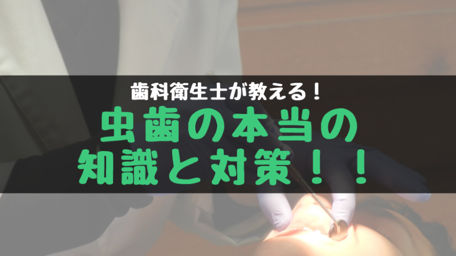 歯科衛生士が教える!虫歯の本当の知識と対策!!